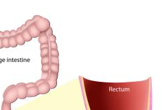 Itchy Bum Hole Meaning