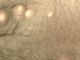 White Dots on Testicles Sac Picture