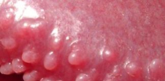 Red Spots on Penis - What are they?